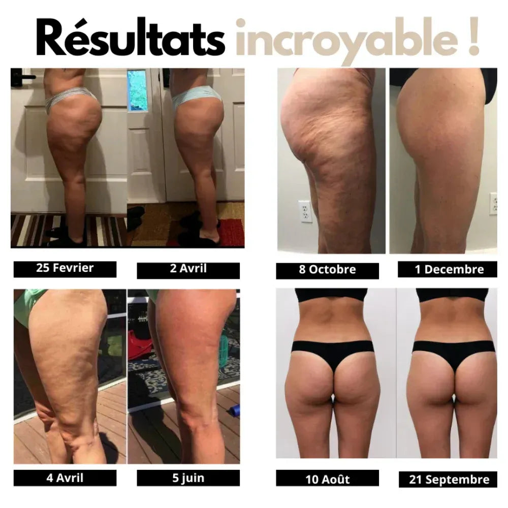 Leggings 3D Anti-Cellulite - Drenova™