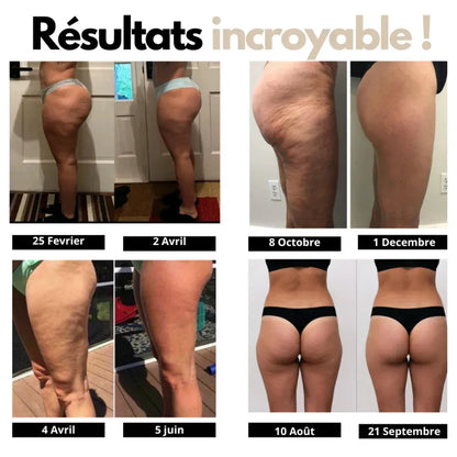 Leggings 3D Anti-Cellulite - Drenova™